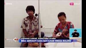 Carbuncle adalah kumpulan bisul yang berkembang dalam kelompok folikel rambut di bawah kulit. Jenis Bisul Tanpa Mata Cute766