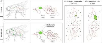 Image result for Primary Tumor Localization