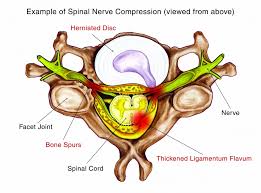 Organs exist in most multicellular organisms, including not only humans and other animals but also plants. Spondylosis Center Spinal Osteoarthritis Symptoms Exercises Treatments
