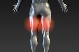 They most often occur at the middle of the back of the thigh where either way, it is essential to spend time working on your hamstring strength in order to avoid injury. Hamstring Issues That Won T Go Away Is Sciatica To Blame Physio Fit Adelaide