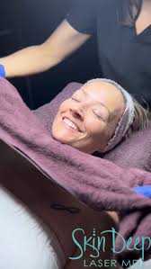 What to Expect After a Chemical Peel: Real Talk from a Skin Expert