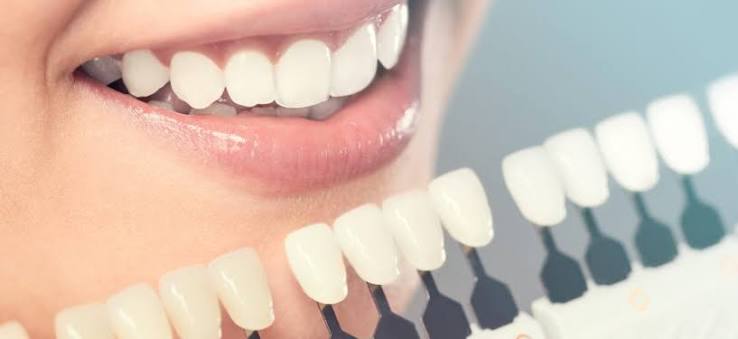 Cosmetic Dentistry | Evaluate the Top Treatments & Trends
