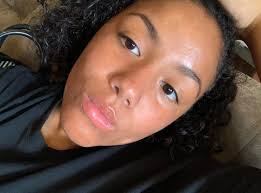 This is my 16 year old daughter. She has been using the 3 in 1 cleansing  bar for 5 consecutive weeks to clear her acne. Look at her progress!!! 🚨  🚨 🚨