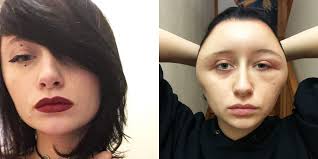 (6) 2 for £14 on selected tigi…. Woman Had Severely Swollen Head After Allergic Reaction To Hair Dye