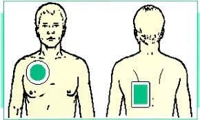The success of electrical cardioversion depends on how long you have had atrial fibrillation and what is causing it. Cardioversion Circulation