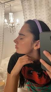 Hello, does anyone have the link to the WhatsApp group for Dr. Ozan Erol? I  am scheduling a primary Rhinoplasty with him in November. Also if anyone  has any useful information on