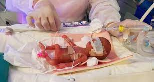 Korea S Smallest Baby Heads Home Hospital 기사본문 Kbr