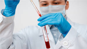 Jumlah total kasus corona di indonesia yakni 2.956 orang. Benarkah Virus Corona Di Indonesia Dengan Wuhan Berbeda