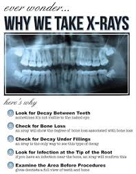 Have You Ever Wondered Why Dentists Always Want To Take An X Ray Here Are The Very Important Reasons Why Dental Fun Dental Hygiene School Dental Hygenist