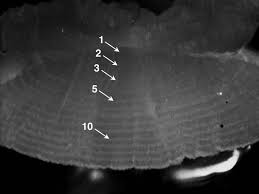 Image Of A Sectioned Otolith Extracted From A Female Flathead Catfish Download Scientific Diagram