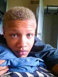 On peut lui bander les yeux avec un lacet de chaussure donc si. 18 Photos Qui Montrent Que La Genetique Peut Parfois Etre Tres Etrange