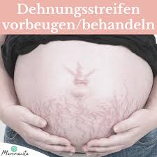 Obwohl noch kein schwangerschaftsbauch zu sehen ist, macht es sinn die haut an den gefährdeten hautpartien mit cremes und ölen vorzubehandeln. Schwangerschaftsstreifen Was Hilft Wirklich Mammacita