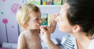 Varsat de vant la porci (tratament veterinar). Au ApÄrut Pe Corp BubiÈe Mici Roz AÈi FÄcut VaricelÄ Cuget Liber