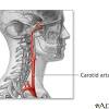 The head and neck receives the majority of its blood supply through the carotid and vertebral arteries. 1