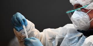 La maladie est souvent asymptomatique ; Coronavirus Pourquoi Un Test Pcr Peut Il Etre Positif Un Mois Apres Une Infection