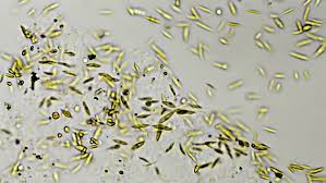 Prokaryotic cells are those cells that do not have a nucleus. Water Algae Lab Sample 400x Stock Footage Video 100 Royalty Free 2176106 Shutterstock