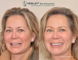We did not find results for: The Dental Facelift Sam Muslin Dds