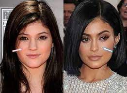 We uncover all cosmetic surgeries that kylie jenner has undergone alongwith faqs on kylie jenner plastic surgery. Pin On Surgery Evolutions