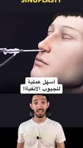 فيديو توضيحي للكشف علي الجيوب الأنفية