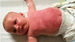 Cancer Council Peppa Pig sunscreen