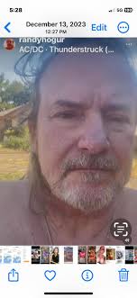 amputee learns to walk again with therapy