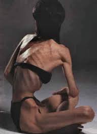 Check out the pronunciation, synonyms and grammar. Thin Ternet The Access To Unhealthy Eating Multi Cultural Cooking Network