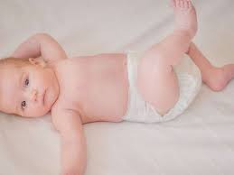 Image result for diaper dermatitis