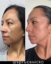 Pigment Perfect® by Spruce Micro