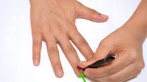 Trauma or damage to the nail itself can cause peeling. How To Fix The Skin Around Your Nails 13 Steps With Pictures
