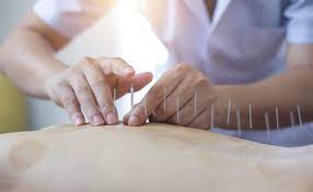 Acupuncture For Parkinson S News Parkinson S Life