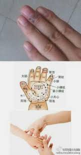 张汉臣治鼻出血的按摩法 主穴 右端正 用手指甲轻轻掐住右端正 直到鼻出血止后 继续掐1分钟 配穴 揉小天心3分钟 补肾经5分钟 清板门穴5分钟 清肺经5分钟 揉阳池穴1分钟 揉二马穴3分钟 清天河水1分钟 pressure points acupuncture peace gesture