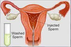 Things were hightened for me with just the ttc process as it was. Iui Intrauterine Insemination