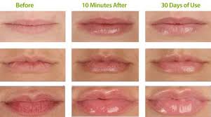 City Lips Lip Plumper I Love This Product My Lips Have Never Felt So Soft After 2 Weeks Lip Lines Are Less Pronou With Images City Lips Lip Plumper Reviews Lip Plumper