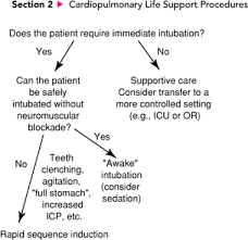 Image result for Rapid Sequence Induction