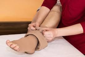Thrombosis is the process of a blood clot, also known as a thrombus, forming in a blood vessel. Geen Compressiekousen Meer Na Trombosebeen Huisarts Wetenschap