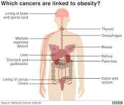The rising rank in mortality is, in some ways, a good thing; Obesity Related Cancers Rise For Younger Us Generations Study Says Bbc News