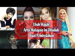 Ubah Wajah Artis Malaysia Ini Dituduh Buat Pembedahan Youtube