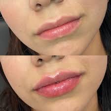 Louis area and belleville, illinois area. Elan Signature Lips Aesthetic Eyes Beauty Book Aesthetic