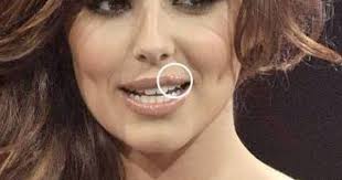 How To Get Rid Of A Cold Sore Overnight Cold Sore Cold Sores Remedies Cold Sore Treatment