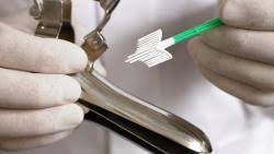 قناع الشعر المعجزة بالسدر