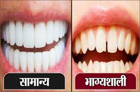 How to manage tooth pain in home. Gap Between Front Teeth Brings Good Luck