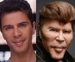 Gone are the days when you could spot somebody who had plastic surgery procedures with ease. 15 Celebs Who Took Plastic Surgery Too Far Bad Celebrity Plastic Surgery Plastic Surgery Gone Wrong Celebrity Plastic Surgery