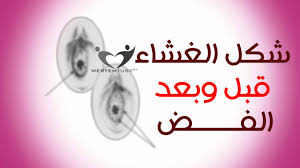 كيف اعرف اني عذراء بطرق بسيطه بالصور إقرأ كيف اعرف اني عذراء بطرق بسيطه بالصور