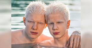 16 People Who Were Endowed With a Magnetic Appearance