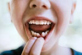 In fact, research published in the international journal of paediatric dentistry in 2018 found that for most children, losing the first primary tooth is associated with. Should You Pull Your Kids Loose Baby Teeth Nj Family