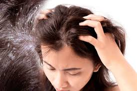 Scalp flaking is mainly caused by sebaceous activity (2). Dry Scalp 6 Secret Hacks To Get Rid Of It