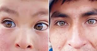 Peruano muestra los ojos 'hazel' de su familia de Cusco y usuarios dicen:  “Yo heredé miopía y astigmatismo”