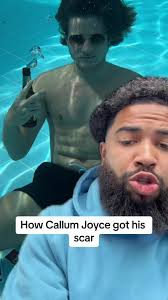 The Shark Encounter: How Callum Joyce Got His Scar