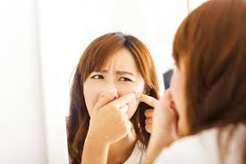 Check spelling or type a new query. Hilangkan Jerawat Dengan 5 Salep Jerawat Ampuh Ini Alodokter
