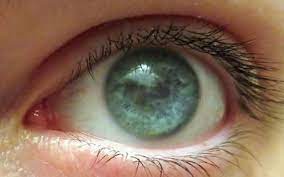 Check spelling or type a new query. Thanks I Hate Pupil Less Eye Tihi